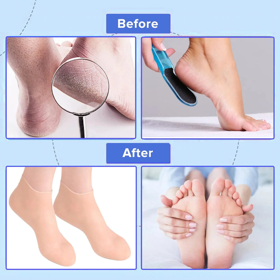 Silicone Moisturizing Socks - High Quality & Long Lasting