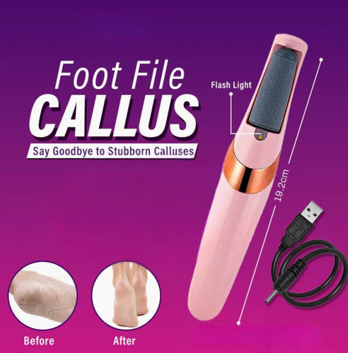 Foot File Callus Remover