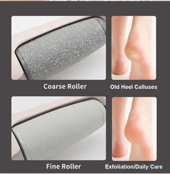 Foot File Callus Remover
