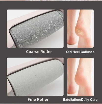 Foot File Callus Remover